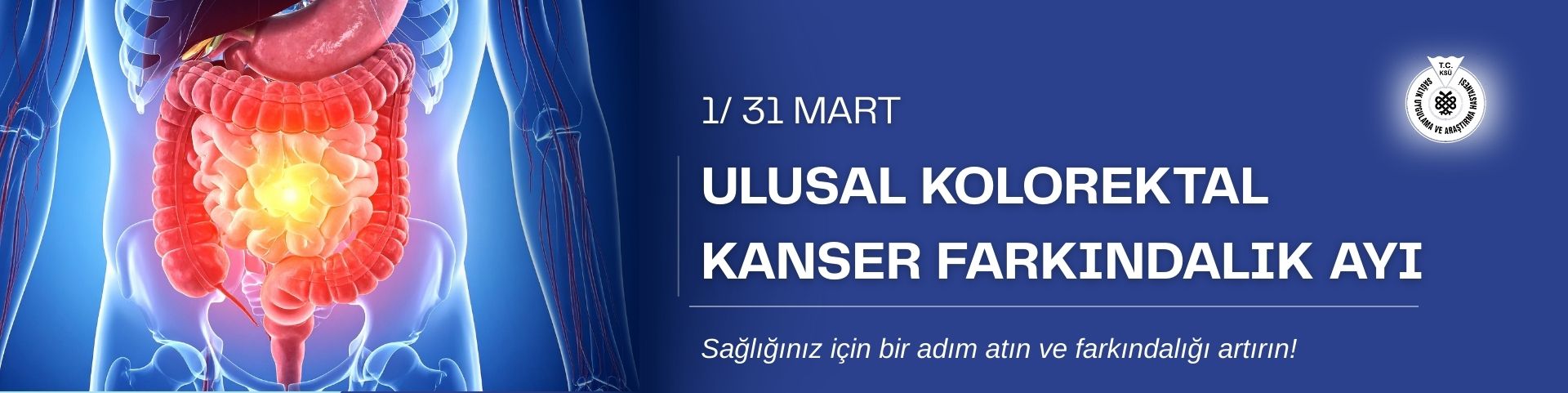 Ulusal kolorektal 1 31 mart